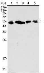 Cytokeratin 8 antibody [8A5D12