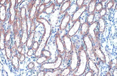 RAB35 antibody [N1C3]