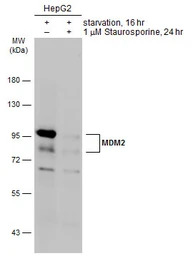 MDM2 antibody [SMP14]