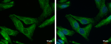 SHANK1 antibody [C3], C-term