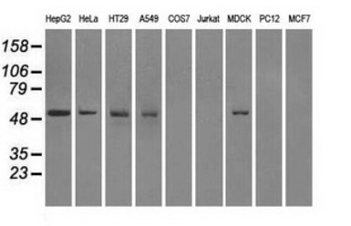 Fumarate hydratase antibody [2