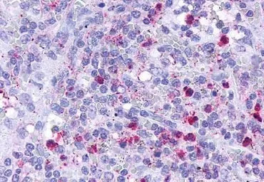 Leukotriene B4 Receptor antibo