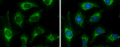 Pyruvate Dehydrogenase E1 beta