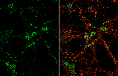 DKK3 antibody [N2C3]