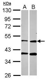 PPOX antibody [N3C3]