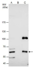 CBS antibody
