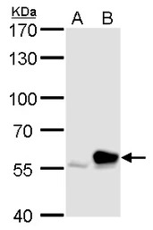 Rhotekin antibody