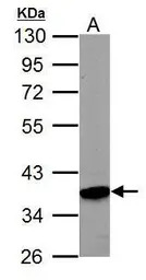 PRPS1 antibody