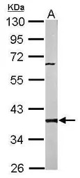 PP2A beta antibody