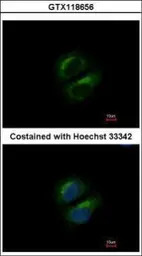 PCBP3 antibody [N1C2]