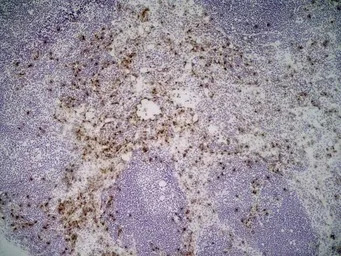 Ly-6B.2 antibody [7/4] (Low en