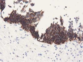 ALDH1L1 antibody [6A10]