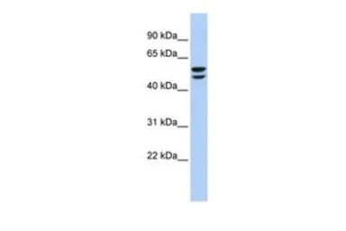 ATP6V1B2 antibody, N-term