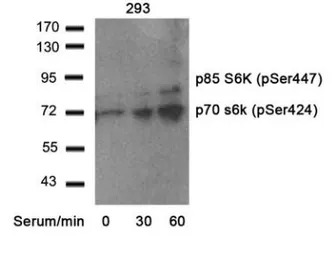 p70 S6K (phospho Ser424) antib