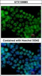 SALL4 antibody [C1C2], Interna