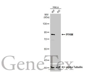 PFKM antibody [C1C3]