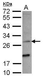 NKG2C antibody [N1N2], N-term