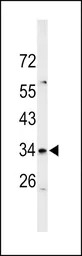 ZIP3 antibody, Internal