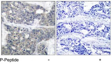 p70 S6K (phospho Thr421) antib
