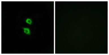 Arylsulfatase D antibody