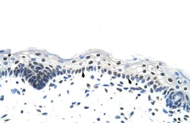 RP11-78J21.1 antibody, N-term