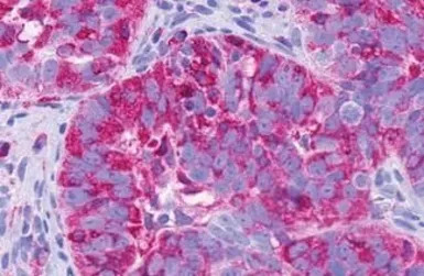 TM7SF1/GPR137B antibody