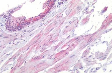 5-HT1B receptor antibody