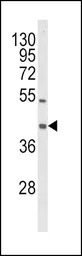 OLR1 / LOX-1 antibody, Interna