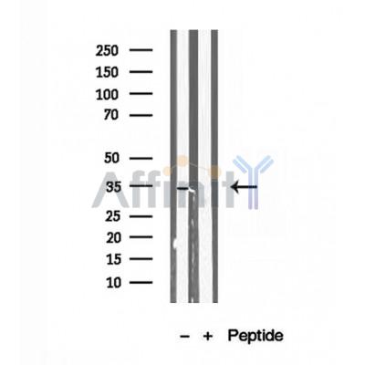 DF12137 SULT1E1 Antibody - Internal WB human adrenal gland tissue