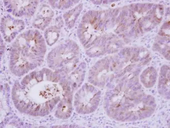 Calcineurin B antibody