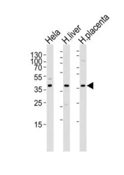 OLR1 / LOX-1 antibody, Interna