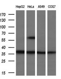 UCK1 antibody [5E9]
