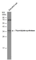 Thymidylate synthase antibody 