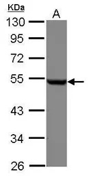 beta Tubulin antibody