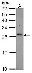 CD70 antibody [C2C3], C-term