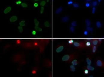 Rad51D antibody [5B3/6]