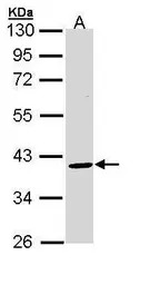 BMP15 antibody [N3C3]