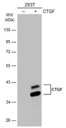 CTGF antibody