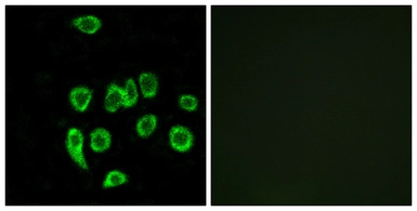 MRPL32 antibody
