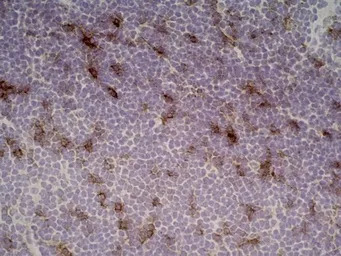 IL2 Receptor alpha antibody [O