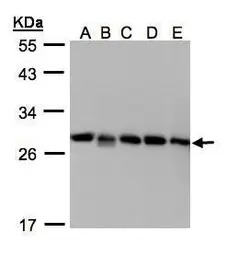 Rho GDI2 antibody [N1C3]