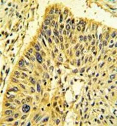 Calponin 1 antibody, N-term