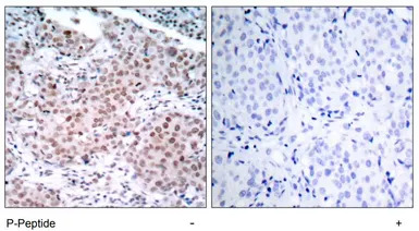 Estrogen Receptor alpha (phosp