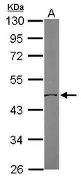 OAT antibody [N1C3]