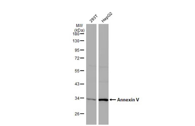 Annexin V antibody