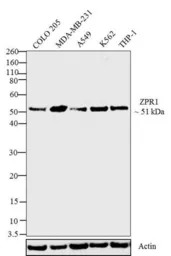 ZNF259 antibody [LG1]