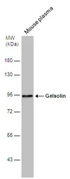 Gelsolin antibody