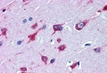 ALS2 antibody, C-term