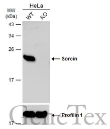Sorcin antibody [N1C3]