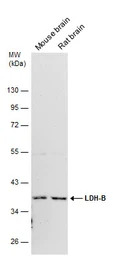 LDH-B antibody